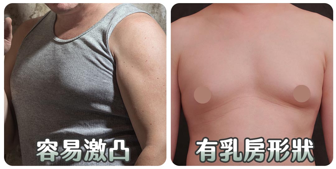 男性女乳症困擾｜容易激凸｜有乳房形狀