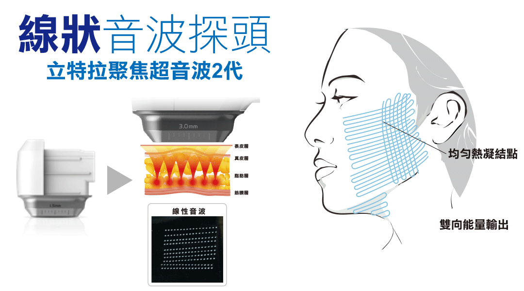 線狀渦漩音波探頭介紹