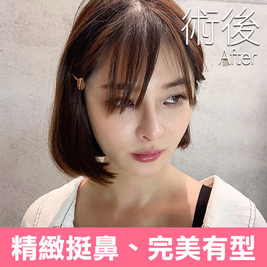 精緻挺鼻、完美有型