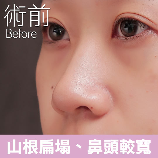 オンラインショップ】 鼻形成術 Aesthetic Rhinoplasty 美容外科手術