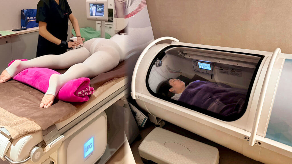 大腿抽脂＋鈦特離子夾術後恢復輔助療程，包含LPG與高壓氧